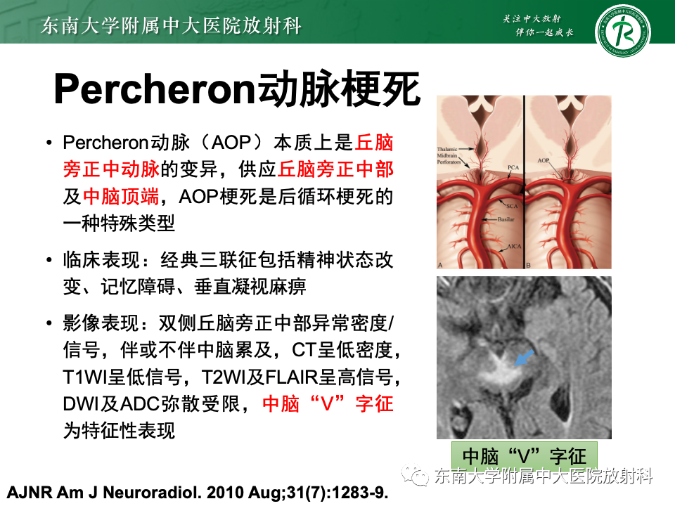 影像PPT - 【PPT】Wernicke脑病-34 影像PPT - 【PPT】Wernicke脑病-34
