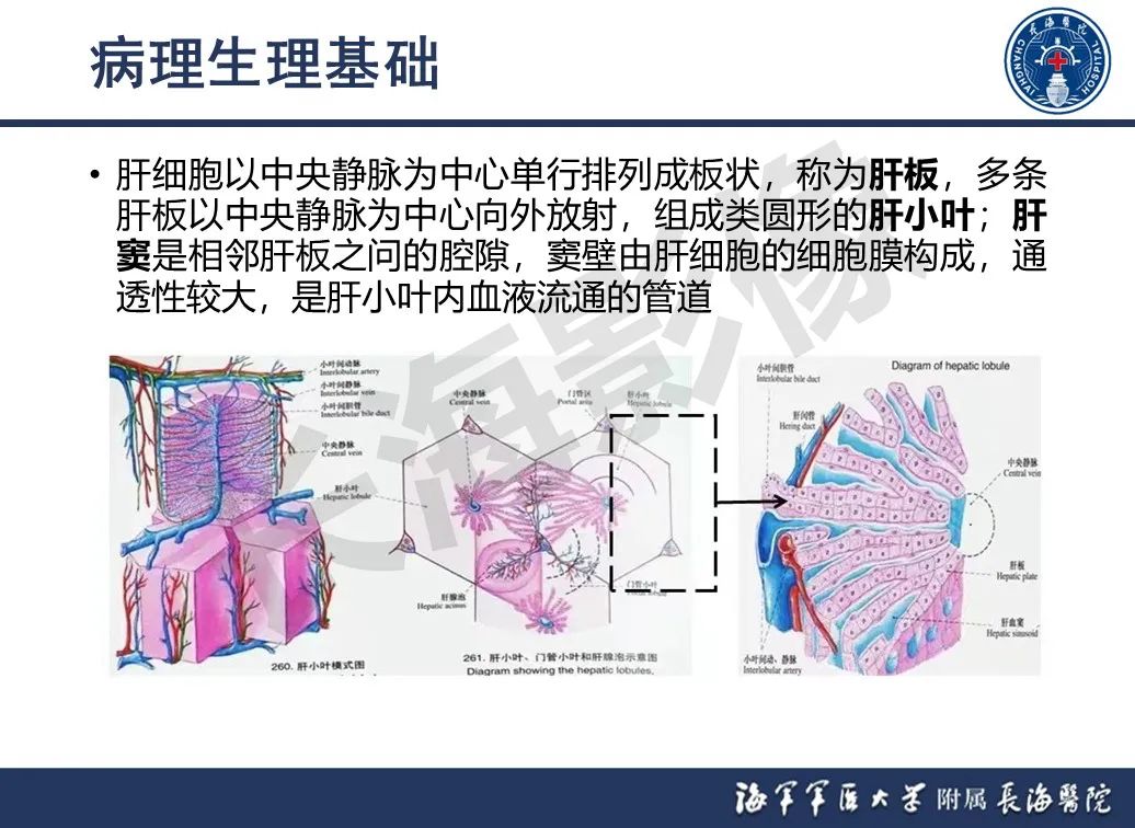 影像PPT - 【PPT】肝窦阻塞综合征的影像学诊断-9