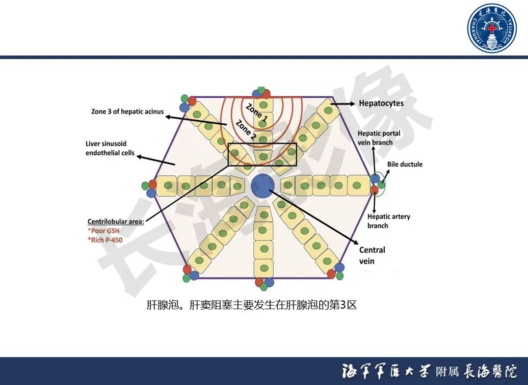 影像PPT - 【PPT】肝窦阻塞综合征的影像学诊断-10