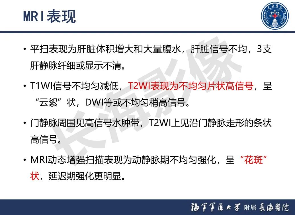 影像PPT - 【PPT】肝窦阻塞综合征的影像学诊断-21