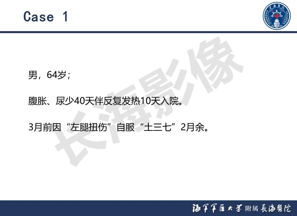 影像PPT - 【PPT】肝窦阻塞综合征的影像学诊断-25