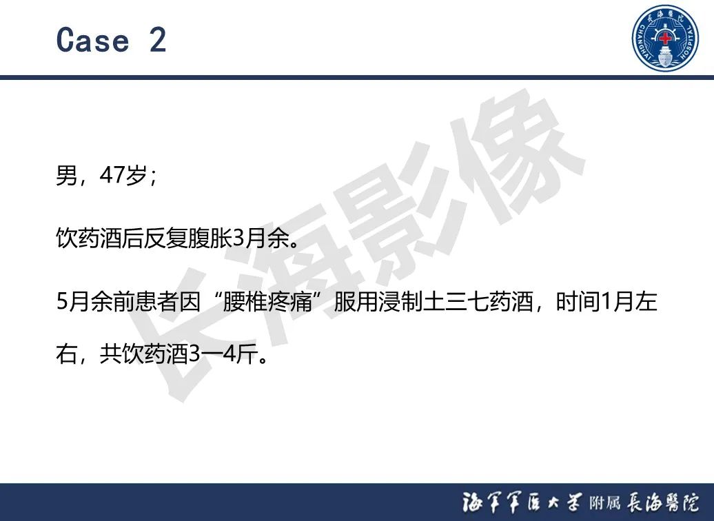 影像PPT - 【PPT】肝窦阻塞综合征的影像学诊断-29