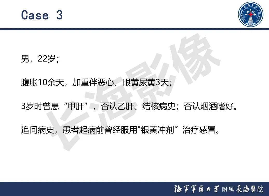 影像PPT - 【PPT】肝窦阻塞综合征的影像学诊断-34