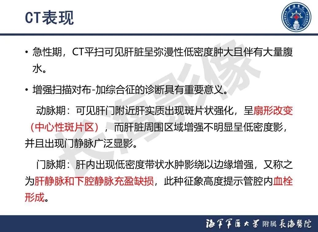 影像PPT - 【PPT】肝窦阻塞综合征的影像学诊断-43