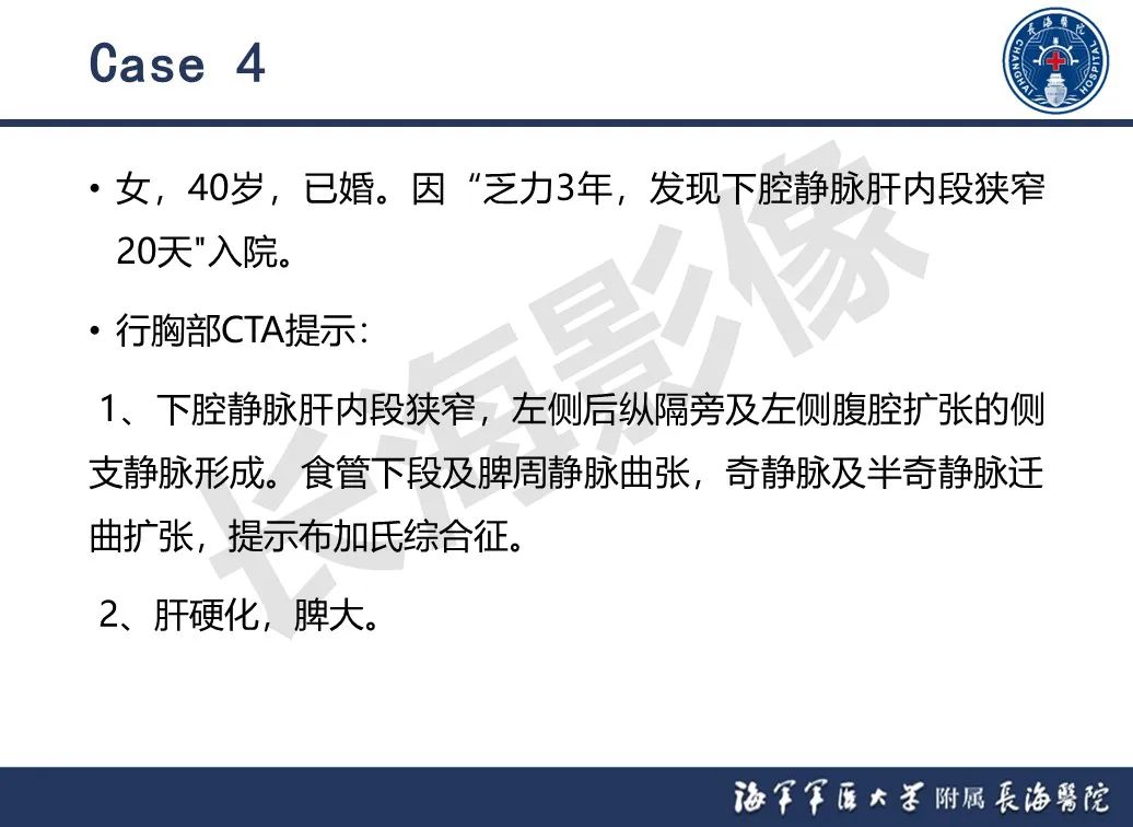 影像PPT - 【PPT】肝窦阻塞综合征的影像学诊断-47