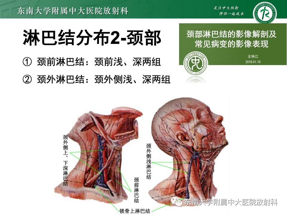 影像PPT - 【PPT】多发性淋巴结增大影像诊断思路-9