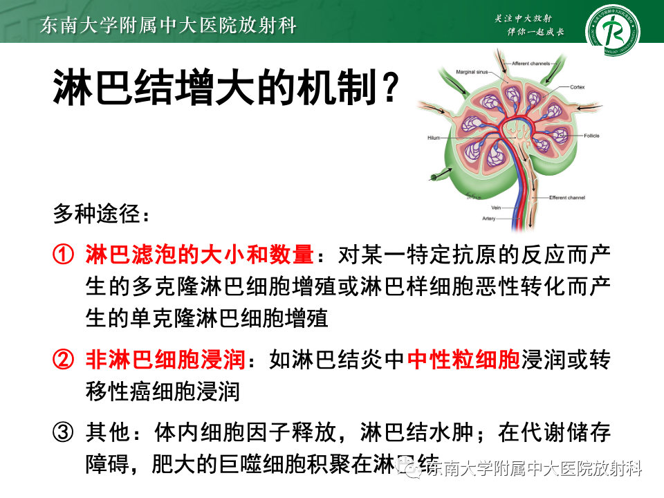 影像PPT - 【PPT】多发性淋巴结增大影像诊断思路-15