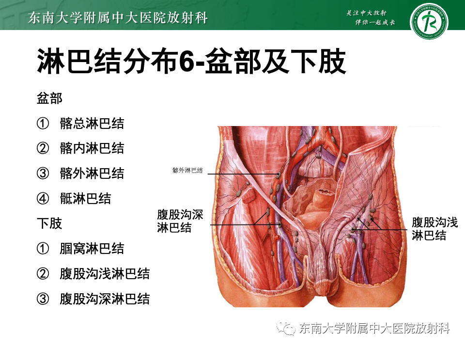 影像PPT - 【PPT】多发性淋巴结增大影像诊断思路-13