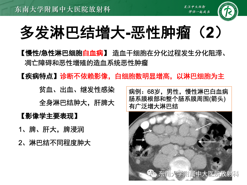 影像PPT - 【PPT】多发性淋巴结增大影像诊断思路-24