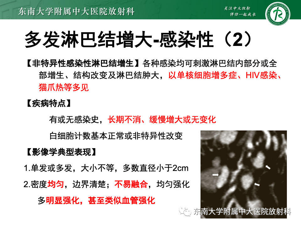 影像PPT - 【PPT】多发性淋巴结增大影像诊断思路-35