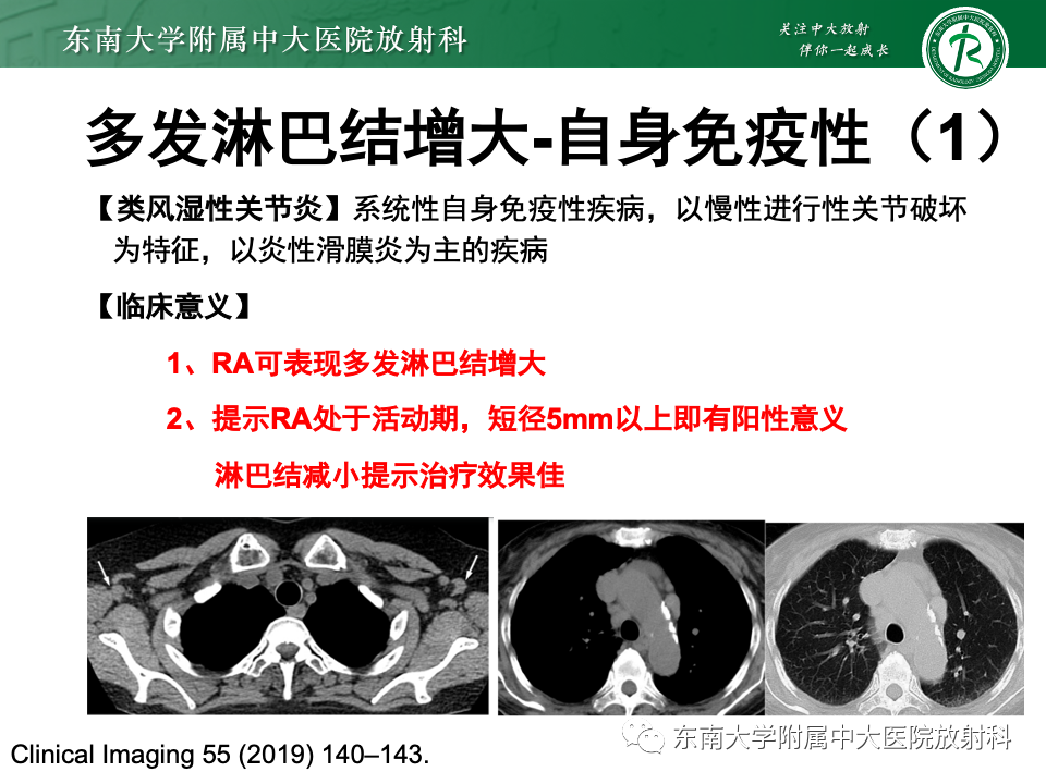 影像PPT - 【PPT】多发性淋巴结增大影像诊断思路-36