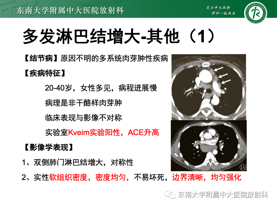 影像PPT - 【PPT】多发性淋巴结增大影像诊断思路-40