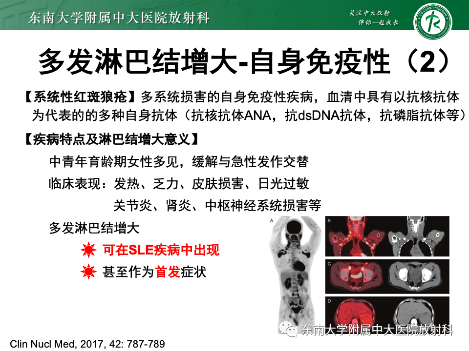 影像PPT - 【PPT】多发性淋巴结增大影像诊断思路-37