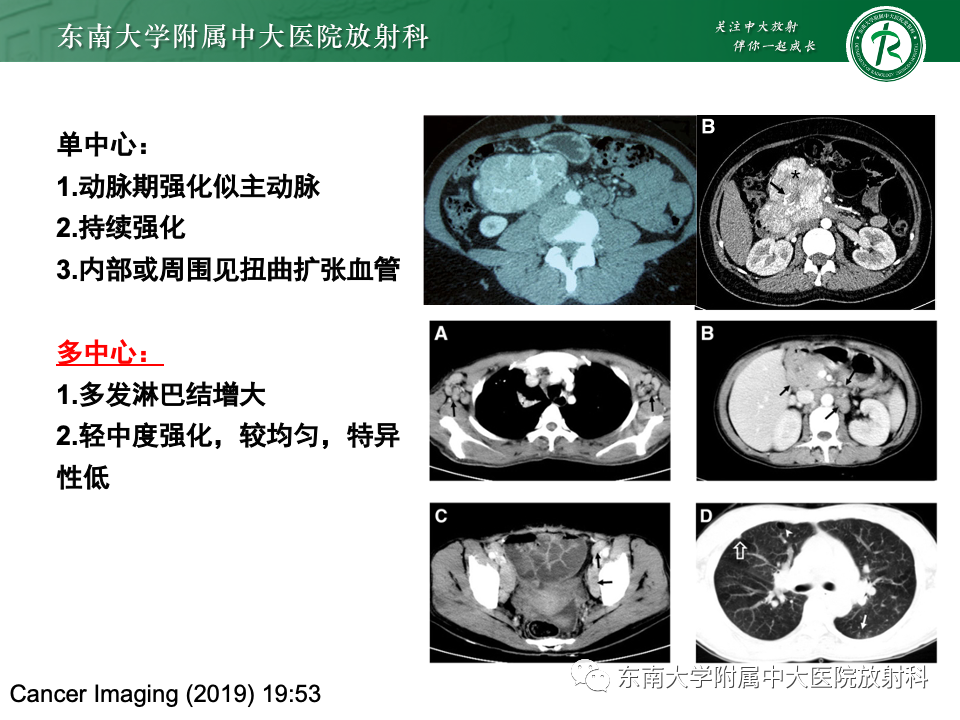 影像PPT - 【PPT】多发性淋巴结增大影像诊断思路-46
