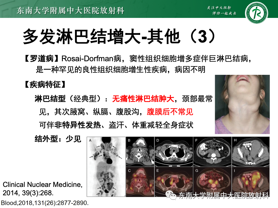 影像PPT - 【PPT】多发性淋巴结增大影像诊断思路-47