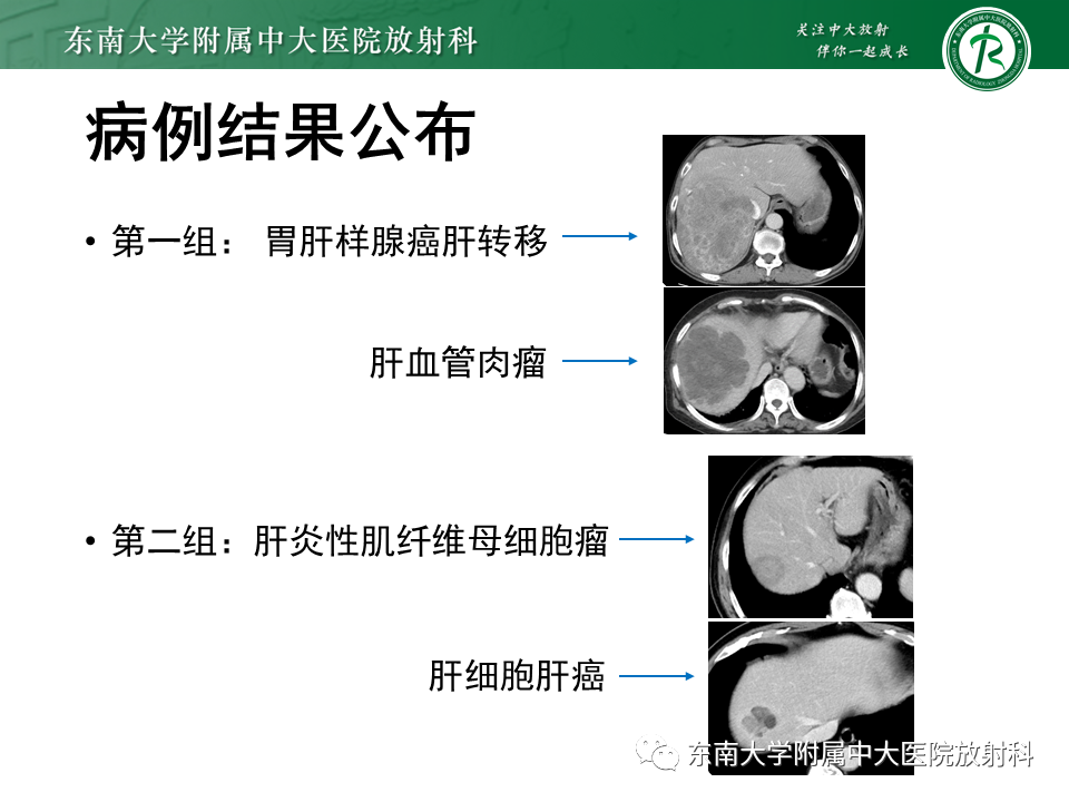 影像PPT - 【PPT】肝脏占位 易误诊病例随访-2