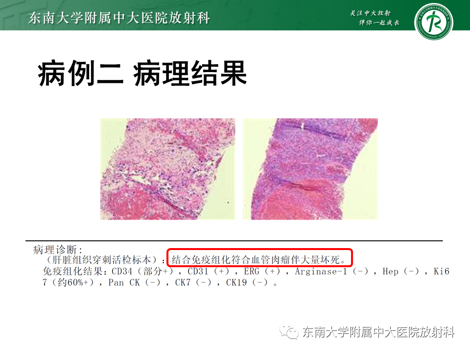 影像PPT - 【PPT】肝脏占位 易误诊病例随访-13
