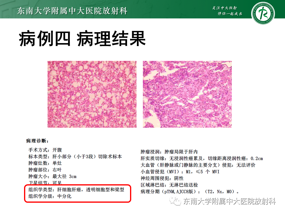影像PPT - 【PPT】肝脏占位 易误诊病例随访-21