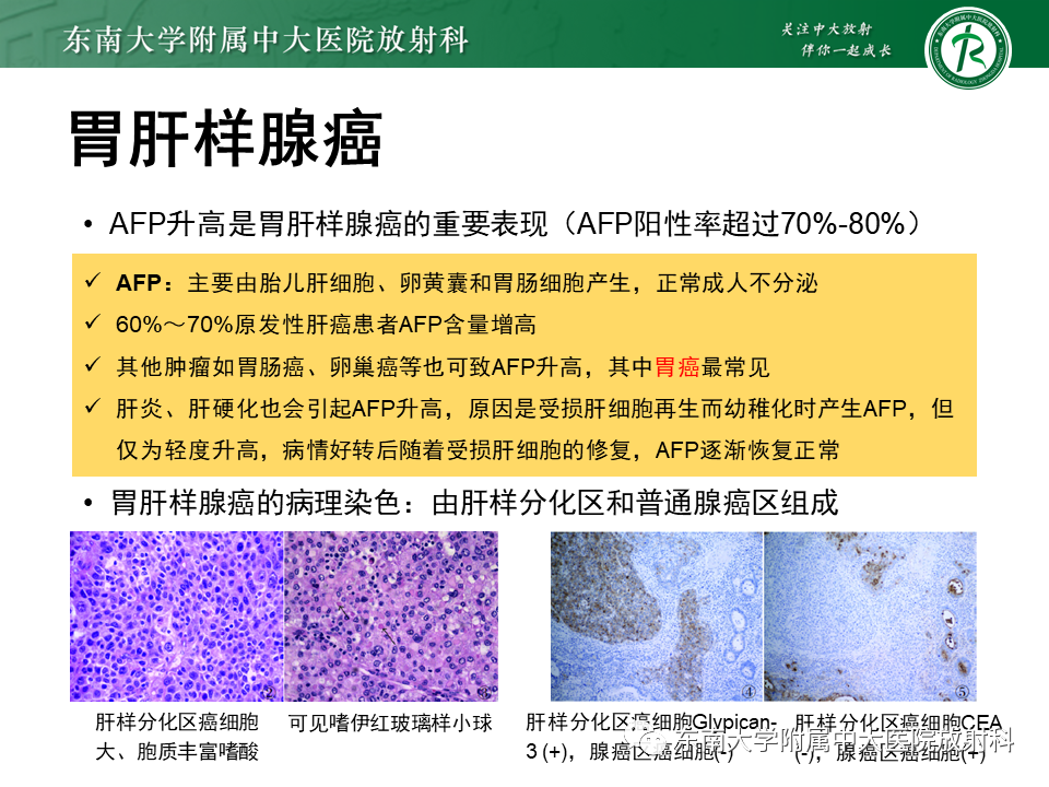 影像PPT - 【PPT】肝脏占位 易误诊病例随访-24