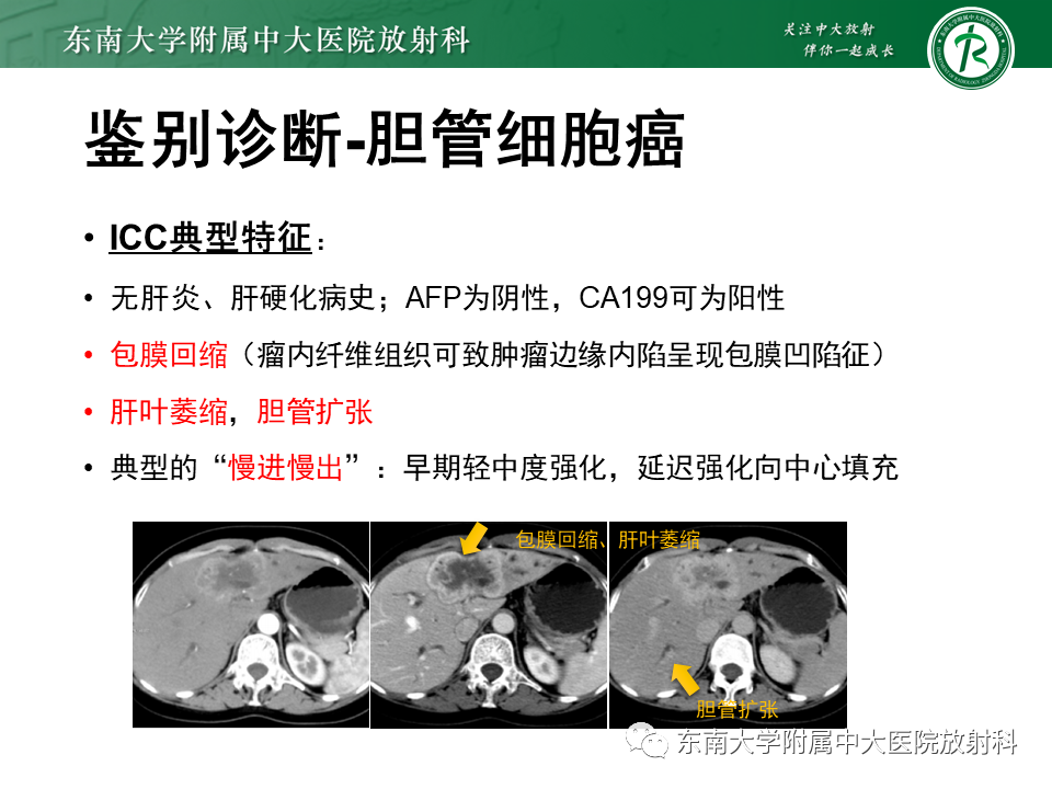影像PPT - 【PPT】肝脏占位 易误诊病例随访-31