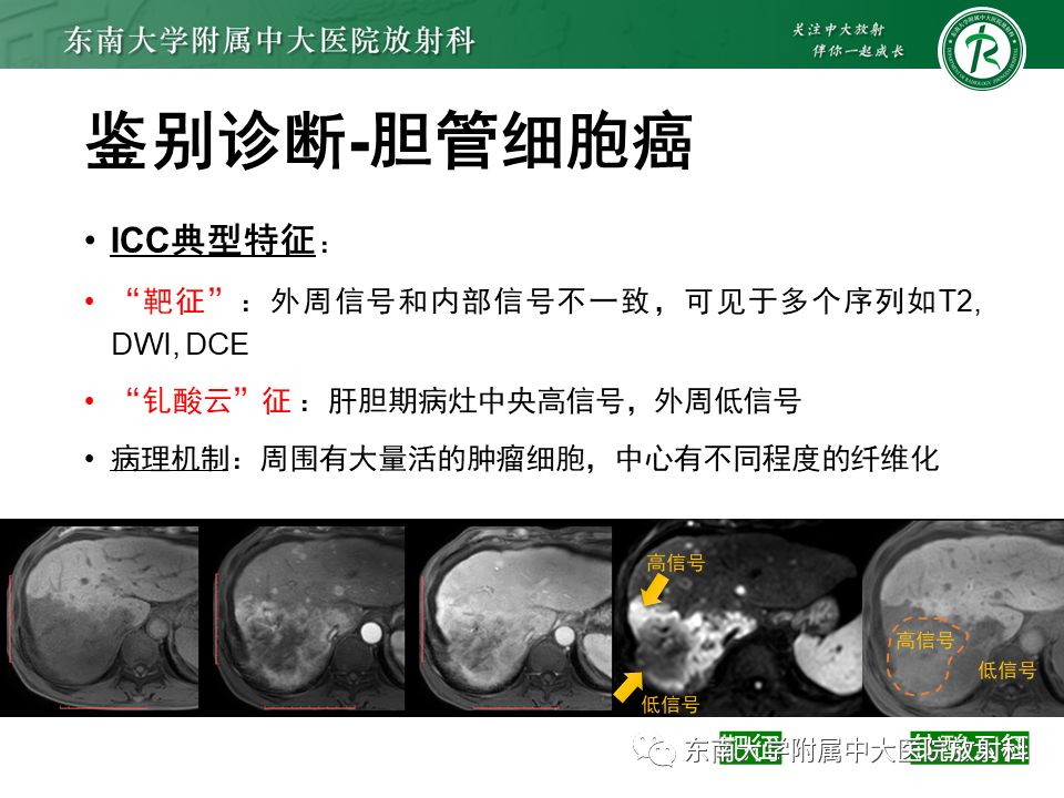 影像PPT - 【PPT】肝脏占位 易误诊病例随访-32
