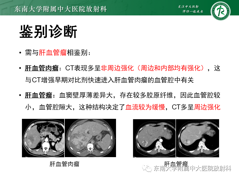 影像PPT - 【PPT】肝脏占位 易误诊病例随访-37