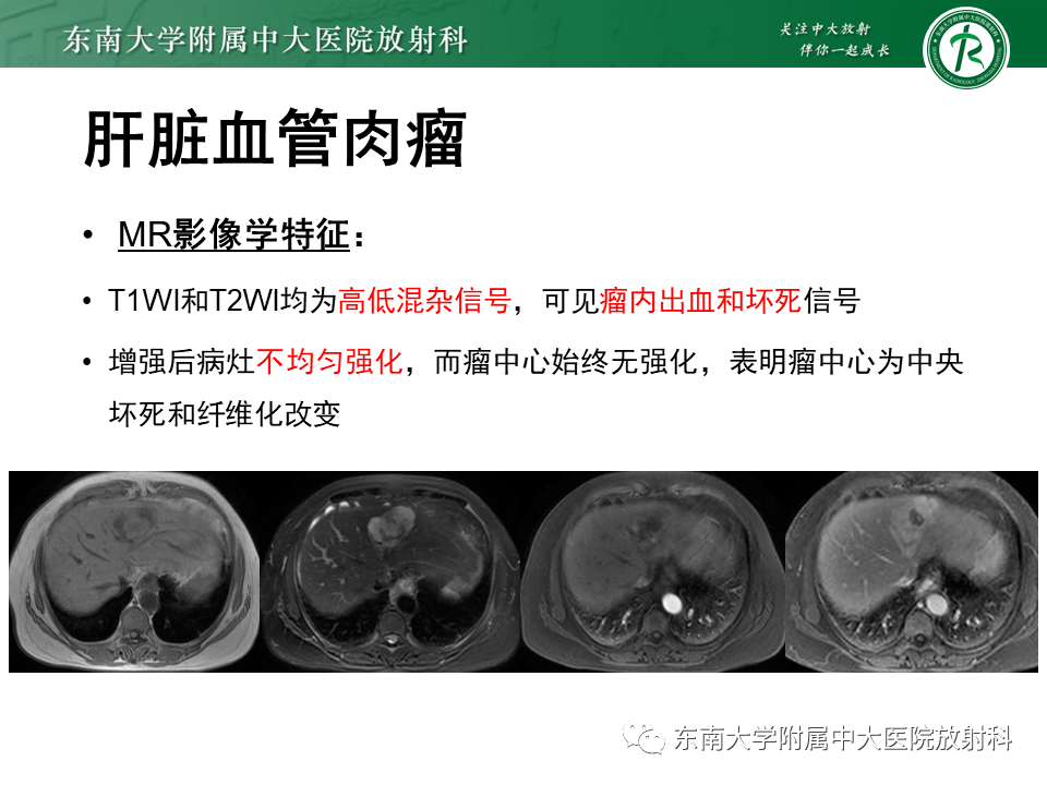 影像PPT - 【PPT】肝脏占位 易误诊病例随访-36