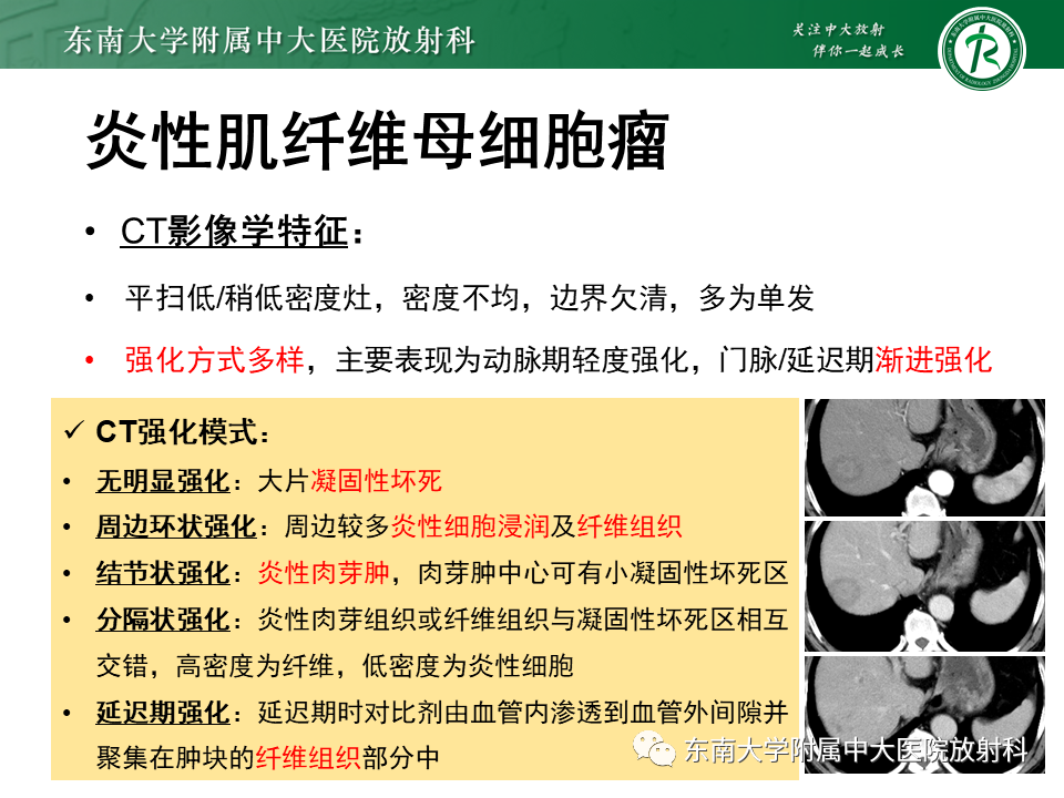 影像PPT - 【PPT】肝脏占位 易误诊病例随访-41