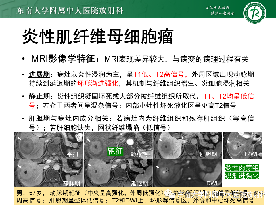 影像PPT - 【PPT】肝脏占位 易误诊病例随访-43