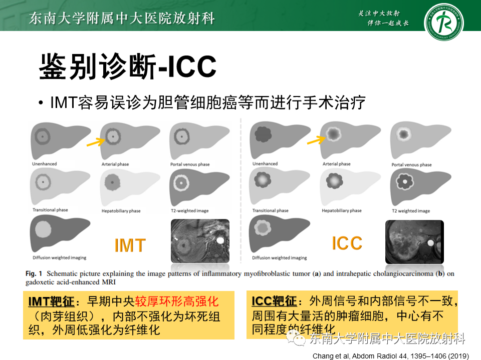 影像PPT - 【PPT】肝脏占位 易误诊病例随访-44
