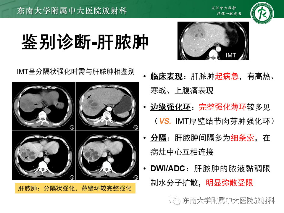 影像PPT - 【PPT】肝脏占位 易误诊病例随访-45