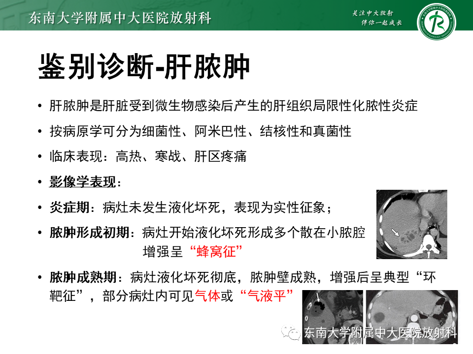 影像PPT - 【PPT】肝脏占位 易误诊病例随访-46
