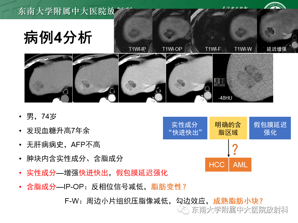 影像PPT - 【PPT】肝脏占位 易误诊病例随访-47