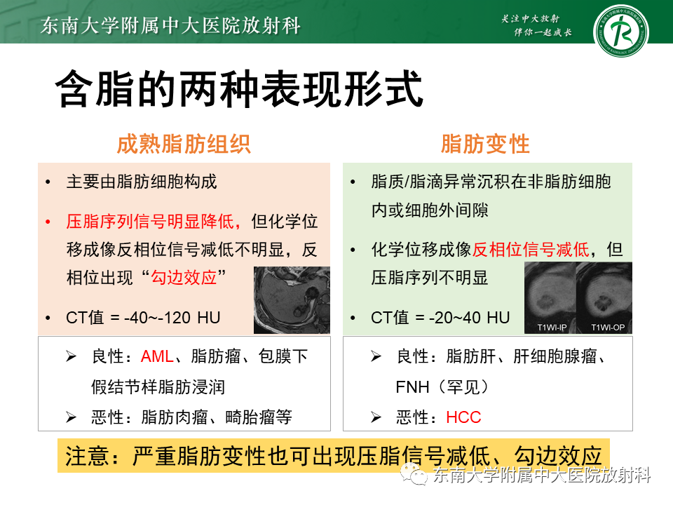 影像PPT - 【PPT】肝脏占位 易误诊病例随访-48