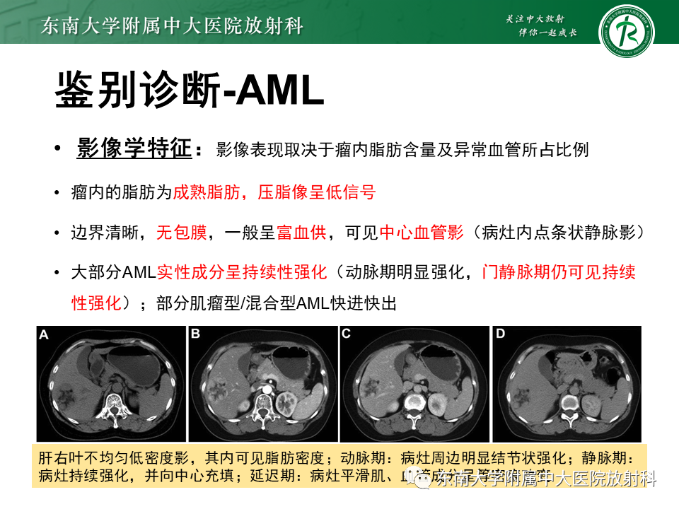 影像PPT - 【PPT】肝脏占位 易误诊病例随访-56