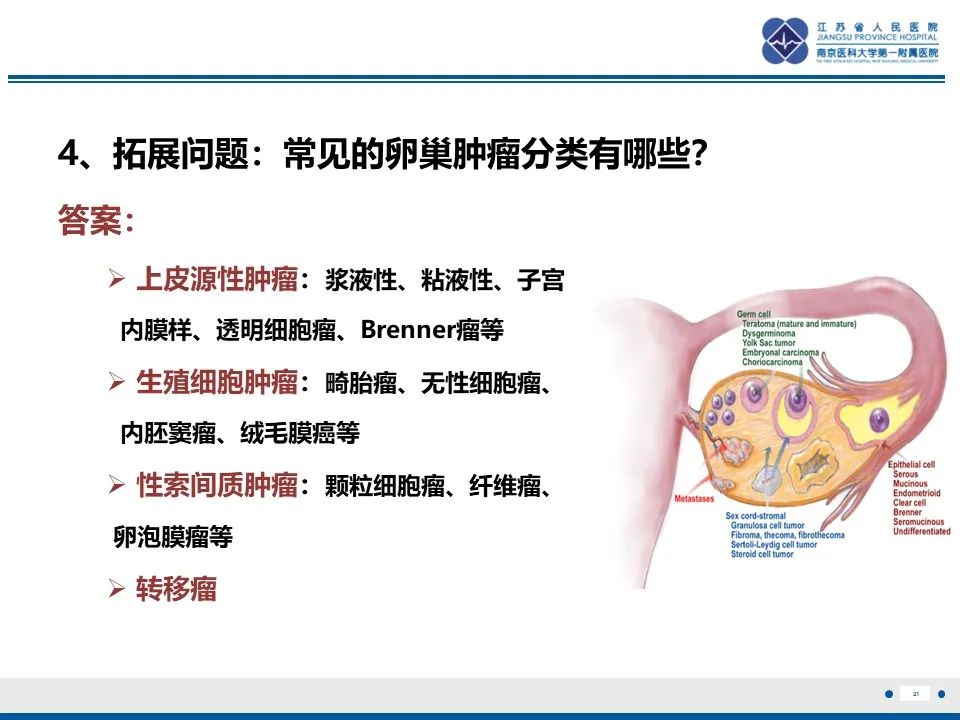影像PPT - 【PPT】卵巢纤维上皮瘤-21