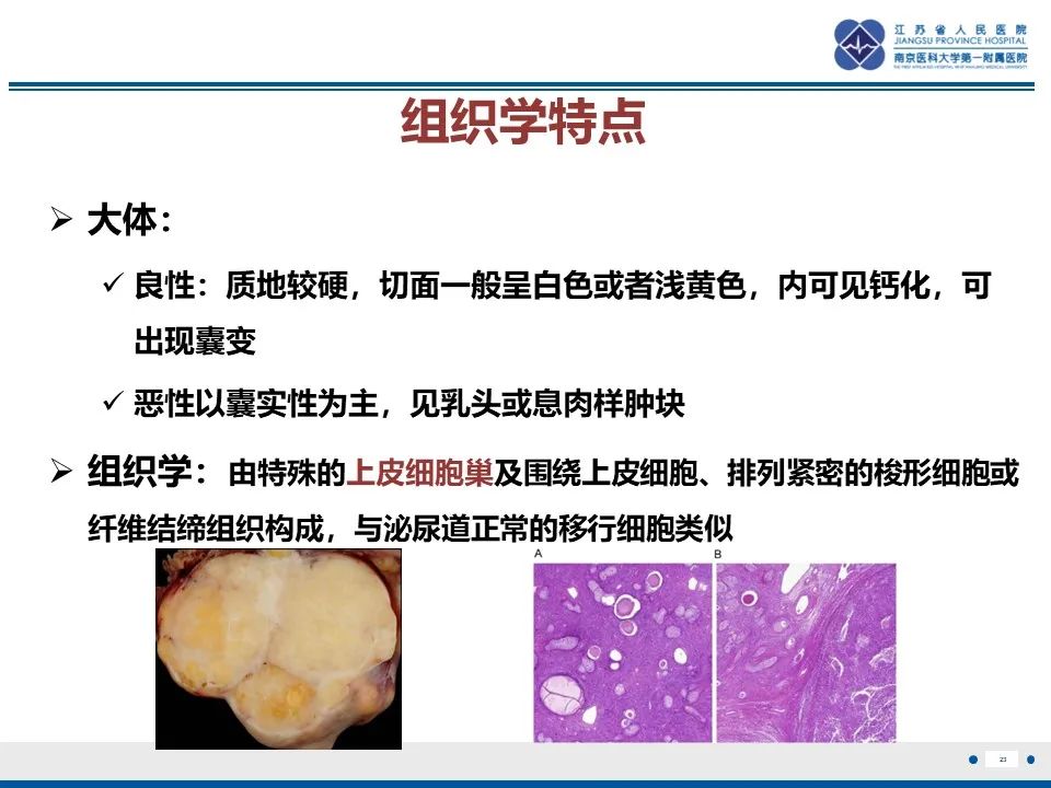 影像PPT - 【PPT】卵巢纤维上皮瘤-23