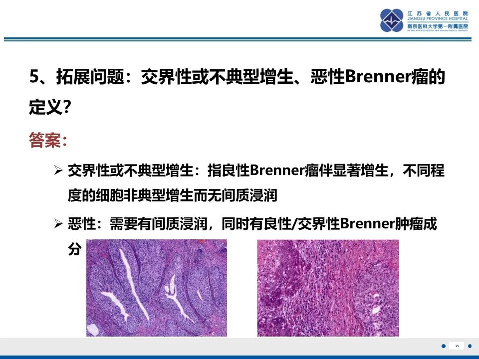 影像PPT - 【PPT】卵巢纤维上皮瘤-25