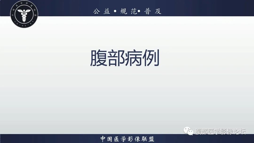 影像PPT - 【病例】原发性肝脏淋巴瘤1例CT及MR-2 影像PPT - 【病例】原发性肝脏淋巴瘤1例CT及MR-2