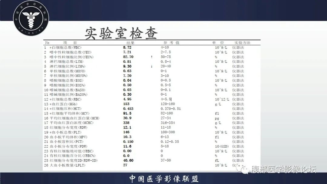 影像PPT - 【病例】原发性肝脏淋巴瘤1例CT及MR-4 影像PPT - 【病例】原发性肝脏淋巴瘤1例CT及MR-4