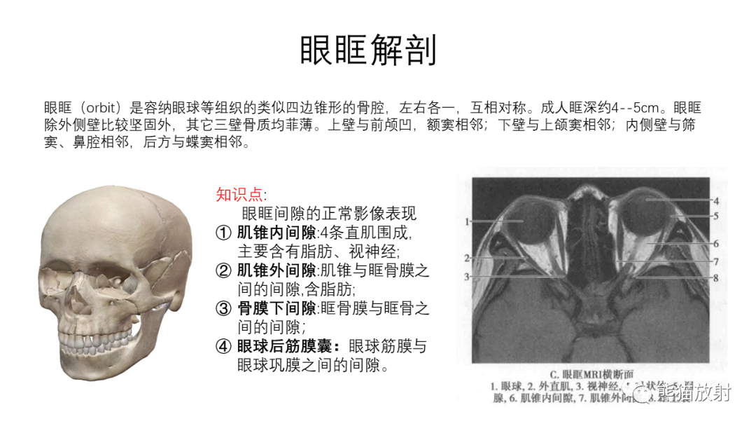 影像PPT - 【病例】眼眶肌锥外间隙 淋巴瘤 VS 孤立性纤维瘤-25