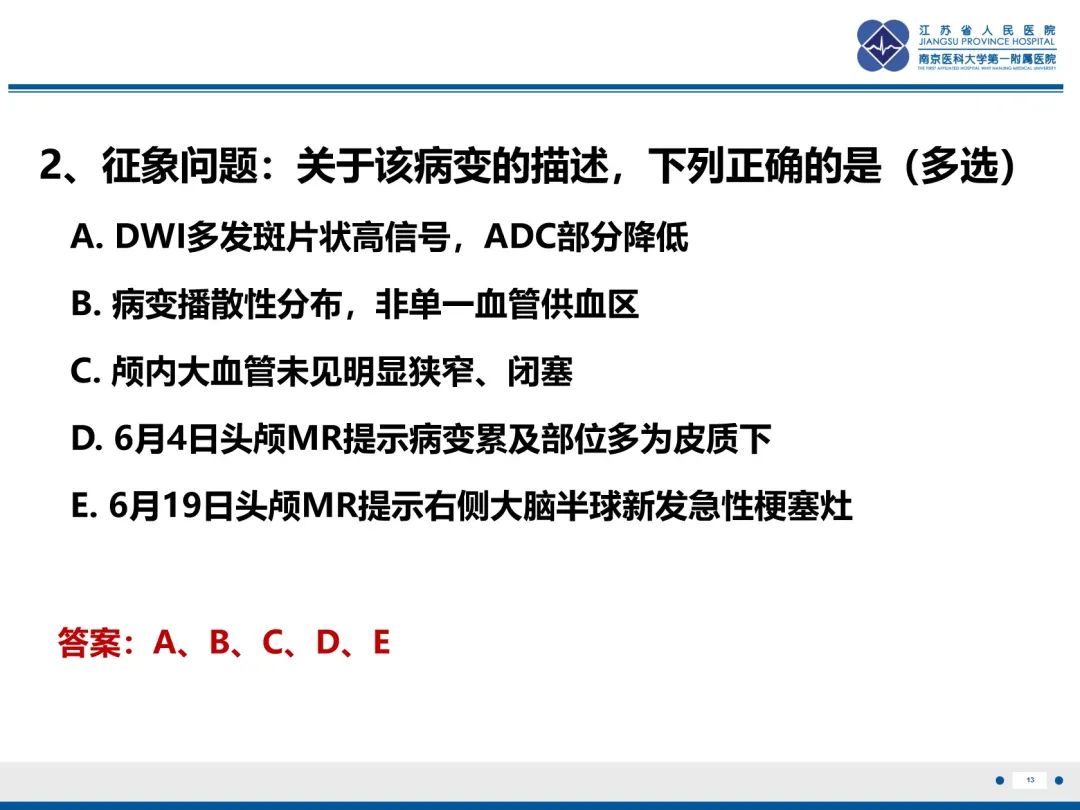 影像PPT - 【PPT】中枢神经系统红斑狼疮-14