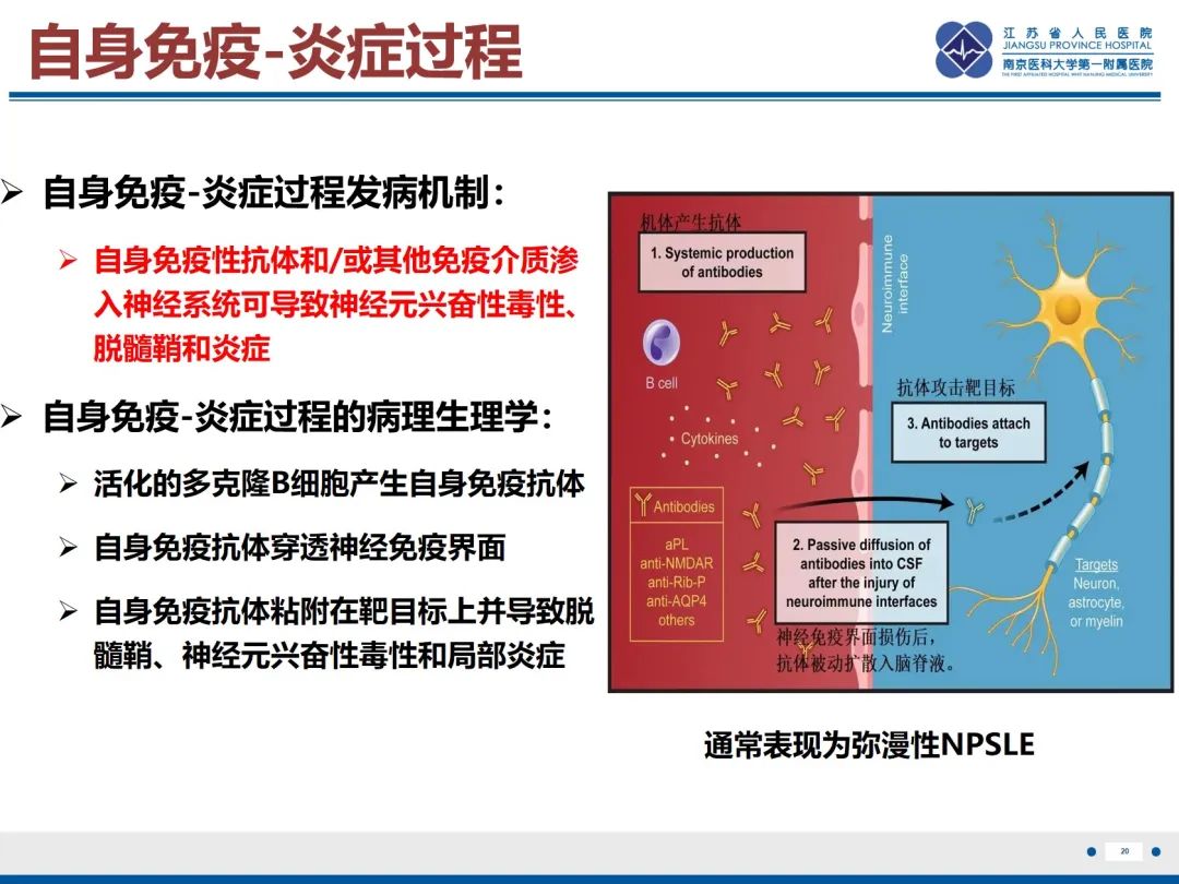 影像PPT - 【PPT】中枢神经系统红斑狼疮-21