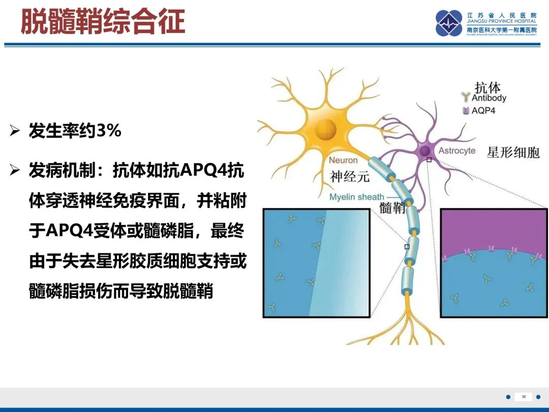 影像PPT - 【PPT】中枢神经系统红斑狼疮-31