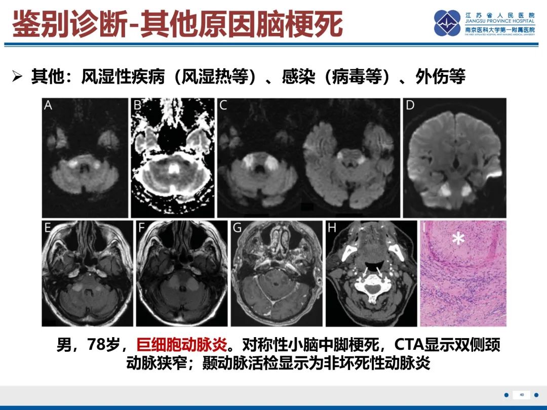 影像PPT - 【PPT】中枢神经系统红斑狼疮-41