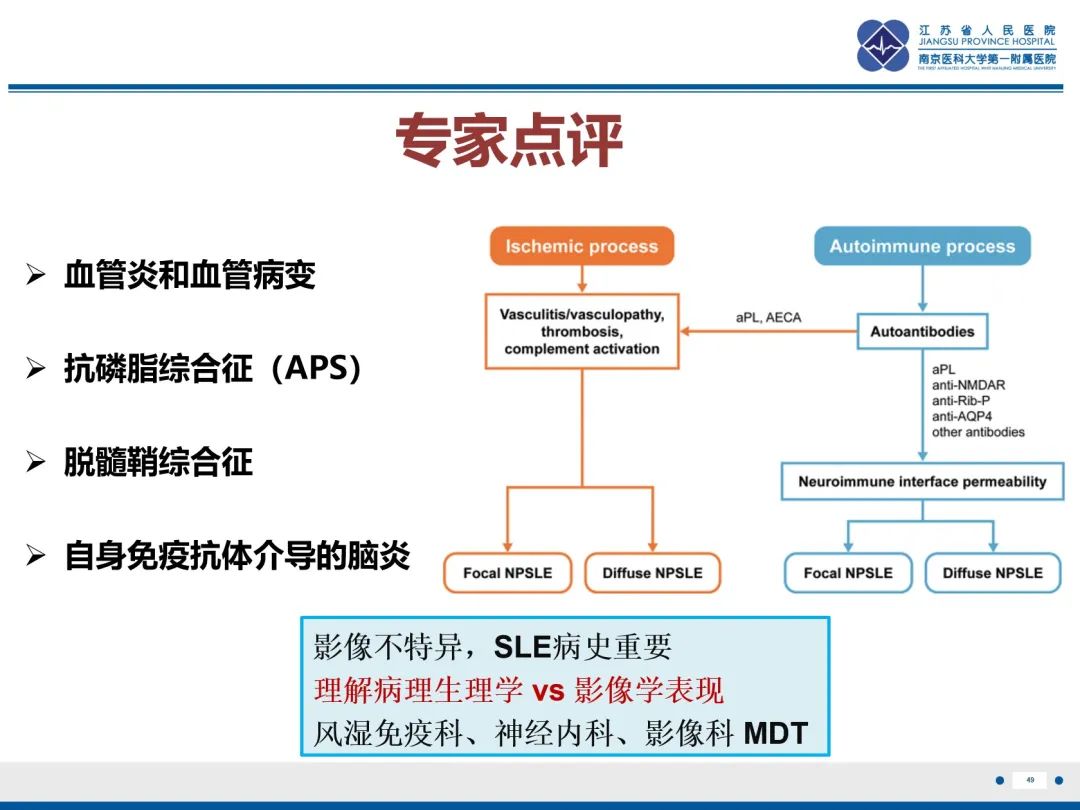 影像PPT - 【PPT】中枢神经系统红斑狼疮-50