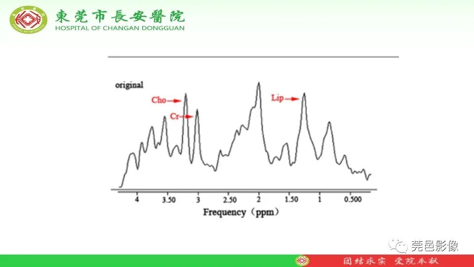 影像PPT - 【PPT】MRI征象在腮腺占位良恶性鉴别中的应用-80