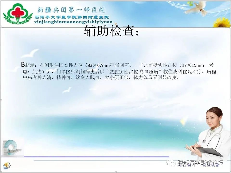 影像PPT - 【病例】卵巢纤维卵泡膜细胞瘤1例CT及MR-4 影像PPT - 【病例】卵巢纤维卵泡膜细胞瘤1例CT及MR-4