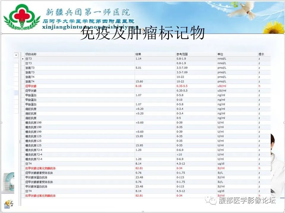 影像PPT - 【病例】卵巢纤维卵泡膜细胞瘤1例CT及MR-6 影像PPT - 【病例】卵巢纤维卵泡膜细胞瘤1例CT及MR-6