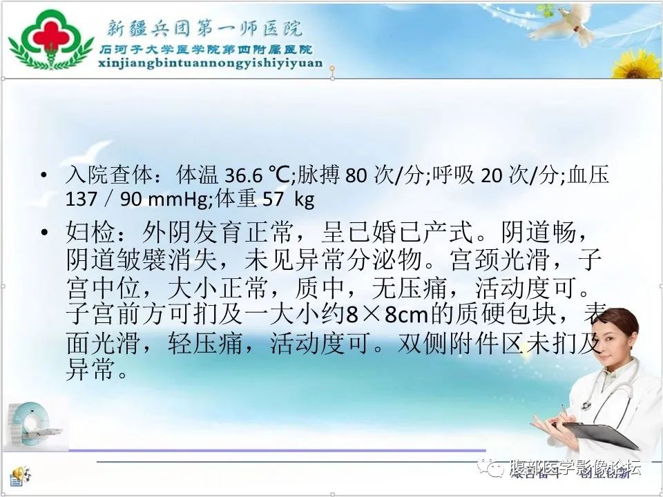 影像PPT - 【病例】卵巢纤维卵泡膜细胞瘤1例CT及MR-3 影像PPT - 【病例】卵巢纤维卵泡膜细胞瘤1例CT及MR-3